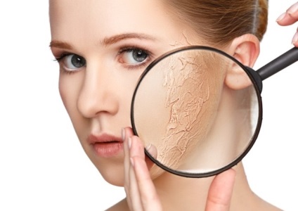 Seborrhoeás dermatitis az arcon -, mit és hogyan kell kezelni