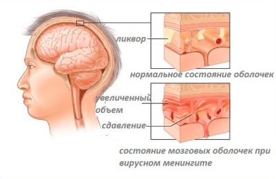 Bump a gyermek nyakát oldalirányban mindkét oldalon, hogy lehet