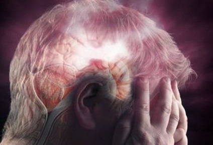 Tünetei és jelei a férfiakban stroke, a népi gyógyászat