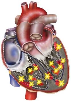 betegellátás színvonala a Cardiology 2014 - kezelés a szív