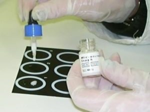 Gyertyák chlamydia - típusok, javallatok és ellenjavallatok, alkalmazás (jelzések) Gyertyák chlamydia - típusok, jelzések és ellenjavallatok, alkalmazás