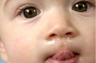 Büdös takony és bűzös szaga orrfolyás gennyes - Okok és kezelés