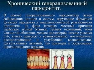 A krónikus foggyökérhártya okoz, tünetek és a kezelés