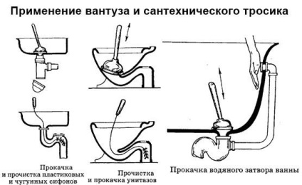 Az illata a szennyvíz a WC okai (szennyvíz szag wc wc) Az illata a szennyvíz a WC okai