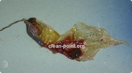 Mi húzza ki a tampont és tiszta lényeg, hogy megy a tampon (tiszta) Mi húzza ki a tampont és tiszta lényeg, hogy megy a tampon