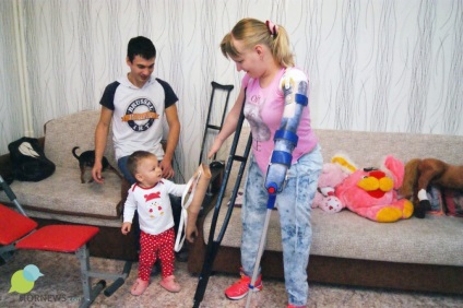 Lány nélkül karok és a lábak a tanulás együtt élni adományozott művégtagok
