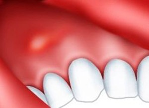 A diagnózis a gyermekgyógyászati ​​fogászat