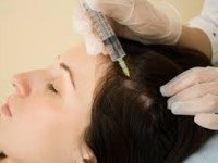 Alopecia areata kezelésére és módszerek (kezelés) Alopecia areata kezelésére és módszerek