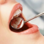 Rothadó fogak okok, kezelés, következményei és vezesse fogászat