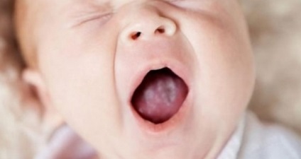 A gomba a szájban a felnőtt és a gyermek orvosi kezelés