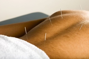 Akupunktúra osteochondrosis a nyaki gerinc, vélemények az előnyeit akupunktúra