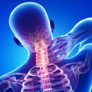 Hogyan lehet gyógyítani arthritis dugootroschatyh ízületi gyulladás (artritisz) Hogyan lehet gyógyítani izületekben dugootroschatyh