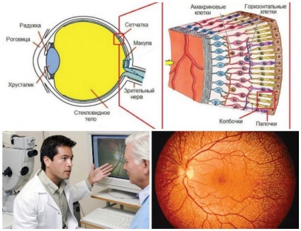 A kezelés a retina a szem, a megerősítése és a teljes helyreállítás