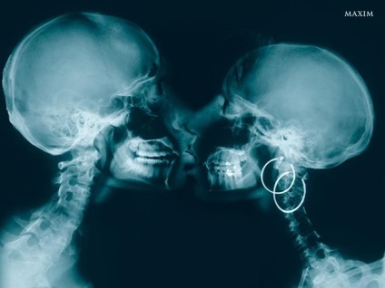 Kíváncsi röntgensugarak → Internet → Medicine, érdekes