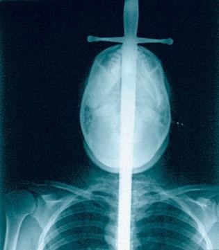 Kíváncsi röntgensugarak → Internet → Medicine, érdekes