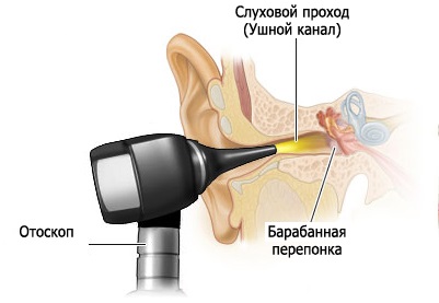 fül vizsgálata otthon