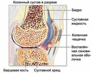 térd osteoporosis kezelés)