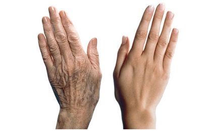 Miért kezünket gyorsabban öregszik, mint a test