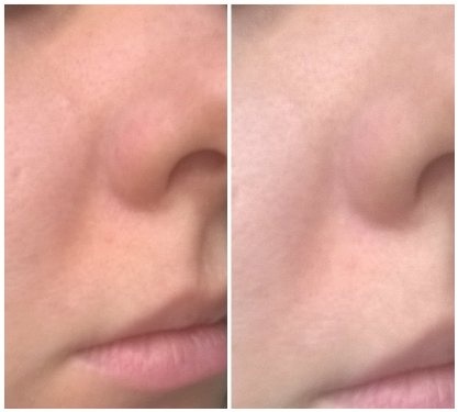 Ritka tulajdonság, anélkül, hogy felemelné a zsír és súlyozása collistar öregedésgátló krém hasznosításra (anti-aging) Ritka tulajdonság, anélkül, hogy felemelné a zsír és súlyozása collistar öregedésgátló krém hasznosításra