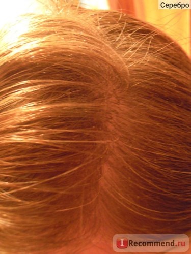Hogy visszaállítják a két vonal antisilverin természetes hajszín - „a legjobb orvosság