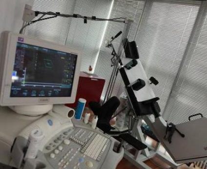 Terheléses echokardiográfia technikája (terheléses echokardiográfia) Terheléses echokardiográfia technikája