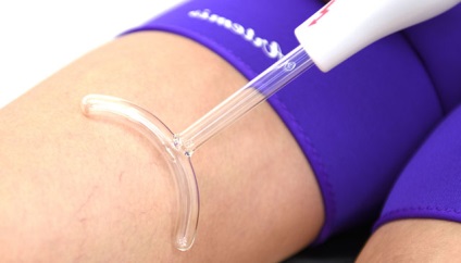 Aktualitások darsonvalya cellulit kezelés szabályainak alkalmazása és hatékonysága (kezelés) Darsonvalya jelenlegi szabályok kezelésére cellulitisz használat és a hatékonyság