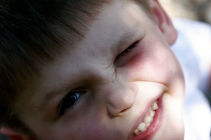 A gyermek rángatózás szem - azaz, az okok és a kezelés, hogyan kell bánni egy ideges tic, miért 4 hónap