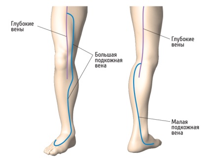 A visszértágulat a lábakon és annak kezelése, a klinika a modern phlebológiai