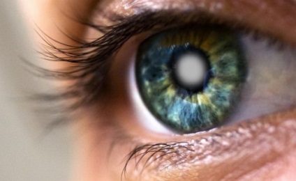Mindent a szürkehályog szem betegség, amely azt jelenti, körülbelül szembetegség
