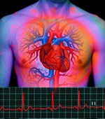 Dystrophiás változások a szívizomban, miokardiális dystrophiában