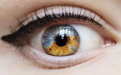 Heterochromiát ember (heterochromia) heterochromia emberek