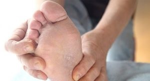 szag a lábujjak között kezelés helminták és a bőr