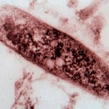 Gyógyszerrezisztens tuberkulózis
