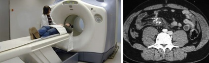 MRI a gyomor és a belek, amely jelzi, ellenjavallatok, előállítási szabályokat