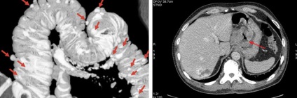 MRI a gyomor és a belek, amely jelzi, ellenjavallatok, előállítási szabályokat