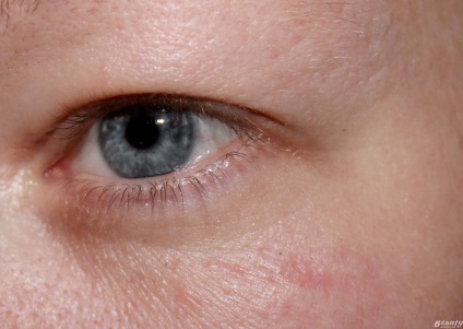 Vélemények a transzformáció krém a szem körüli bőr Olay teljes hatását 7 egy