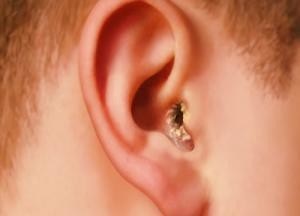 Az értékvesztés és halláskárosodás okait és kezelését, a mértéke a probléma