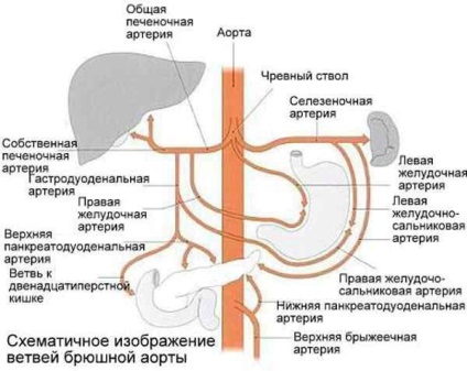 Atherosclerosis okoz hasi aorta, a tünetek, diagnózis, kezelés, következményei