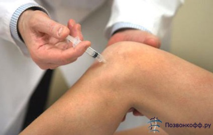 Szteroid injekciós fájdalomcsillapítás Blokád térd artrózissal ár