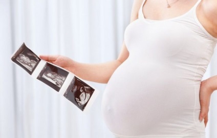 Mi a CTE terhességi ultrahang hétről hétre, az asztal