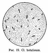 Clostridium botulinum, egészségügyi ellenőrzés