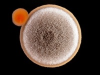 A gombák az Aspergillus nemzetség leírása és klinikai következményei