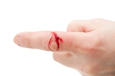 Hogyan lehet megállítani a vérzést vágások a kezét
