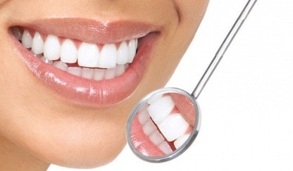 Hogyan lehet fenntartani az egészségügyi fogak egészségét