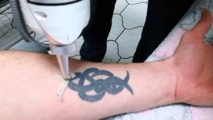Hogyan készítsünk egy tetoválás