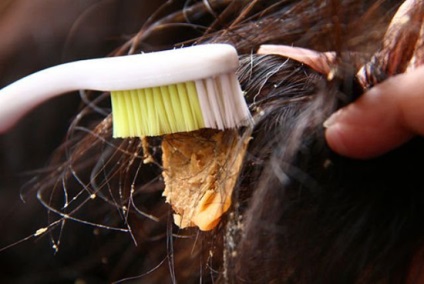 Hogyan lehet eltávolítani a gumiréteg haj, bármilyen hosszúságú módon