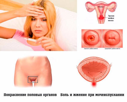 Mi chlamydia képileg a nők és férfiak