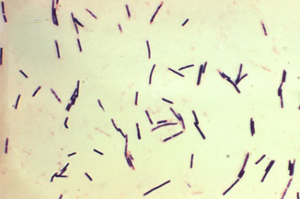 Clostridium perfringens (Clostridium perfringens)