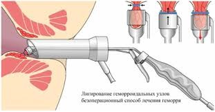 Coloproctological központ kgbuz - Városi Kórház №10 - Minisztérium