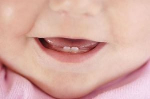Червоні щоки при прорізуванні зубів у дитини - фото і причини почервоніння